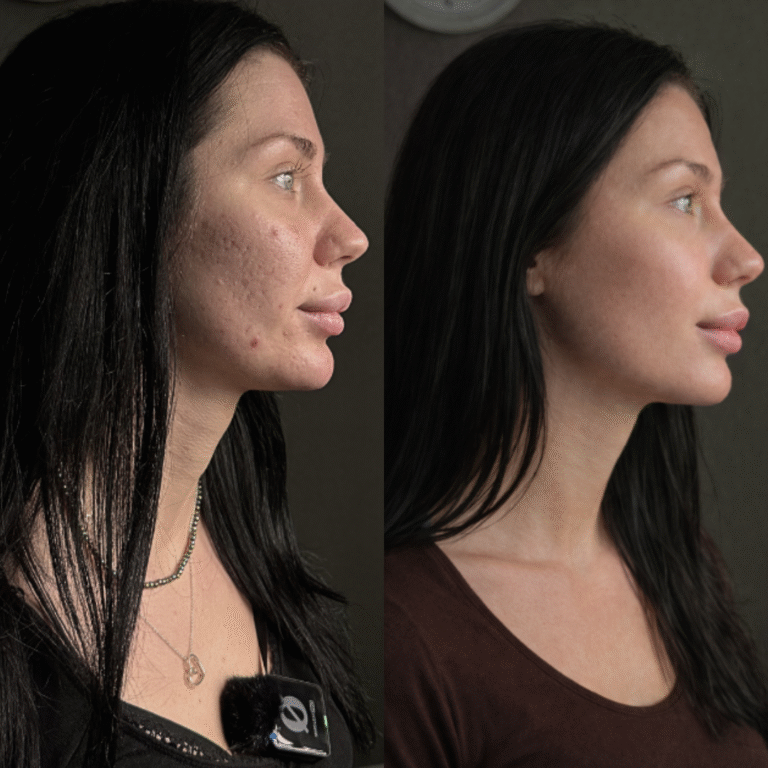 METAMORFOZY STOCK RUS - 2026-02-03T131417.811